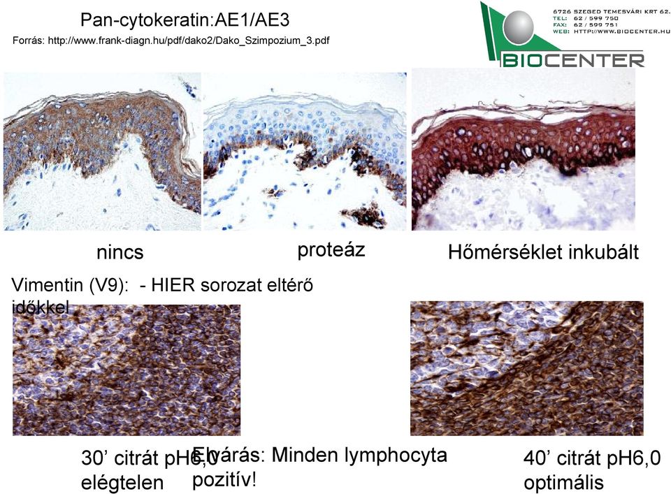 pdf nincs proteáz Hőmérséklet inkubált Vimentin (V9): - HIER