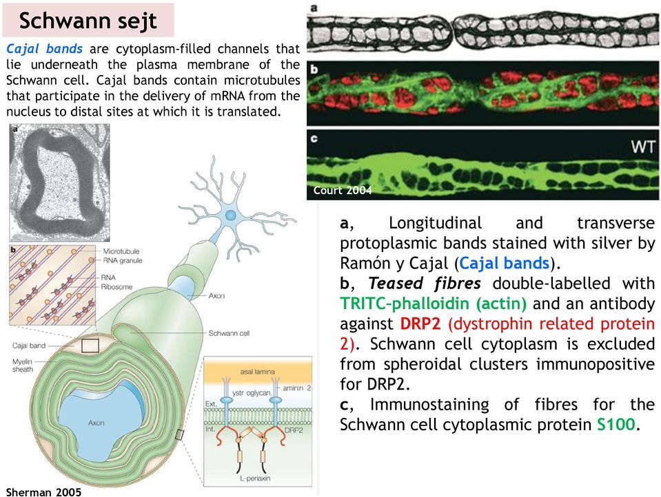 Court 2004 a, Longitudinal and transverse protoplasmic bands stained with silver by Ramón y Cajal (Cajal bands).