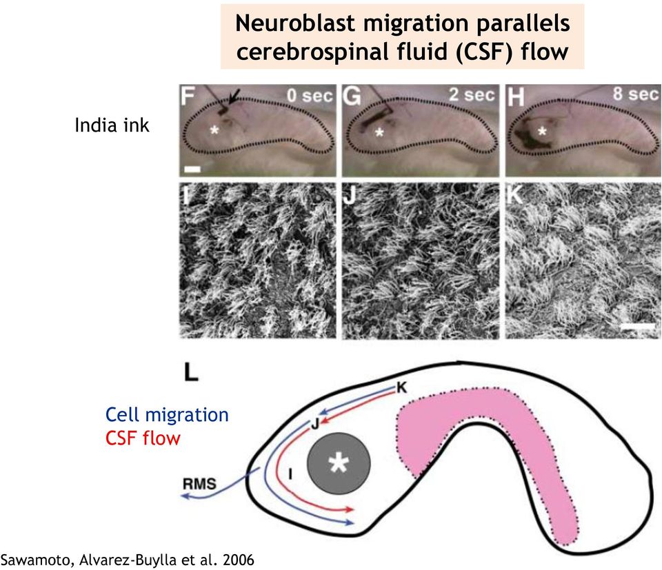 India ink Cell migration CSF