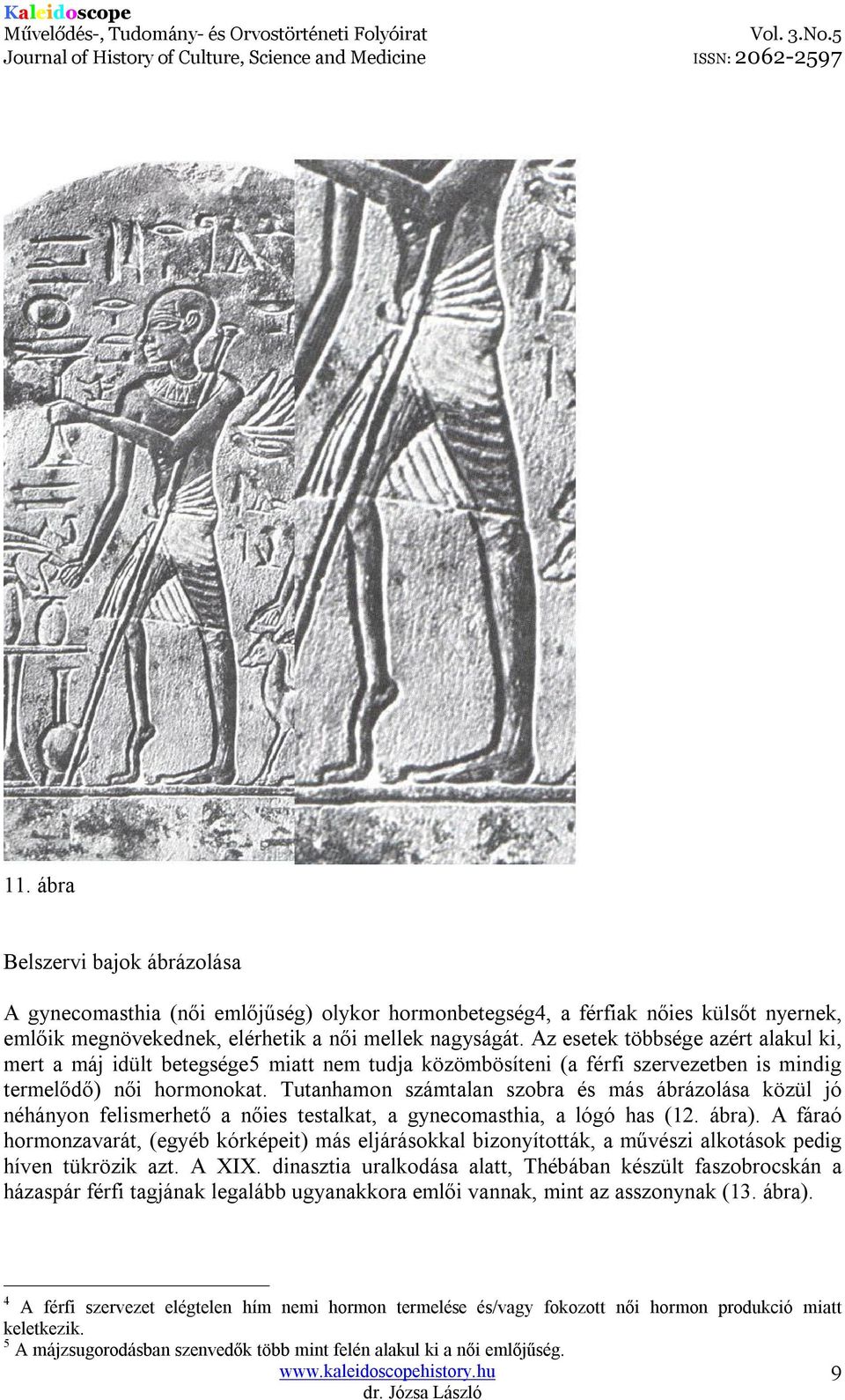 Tutanhamon számtalan szobra és más ábrázolása közül jó néhányon felismerhető a nőies testalkat, a gynecomasthia, a lógó has (12. ábra).