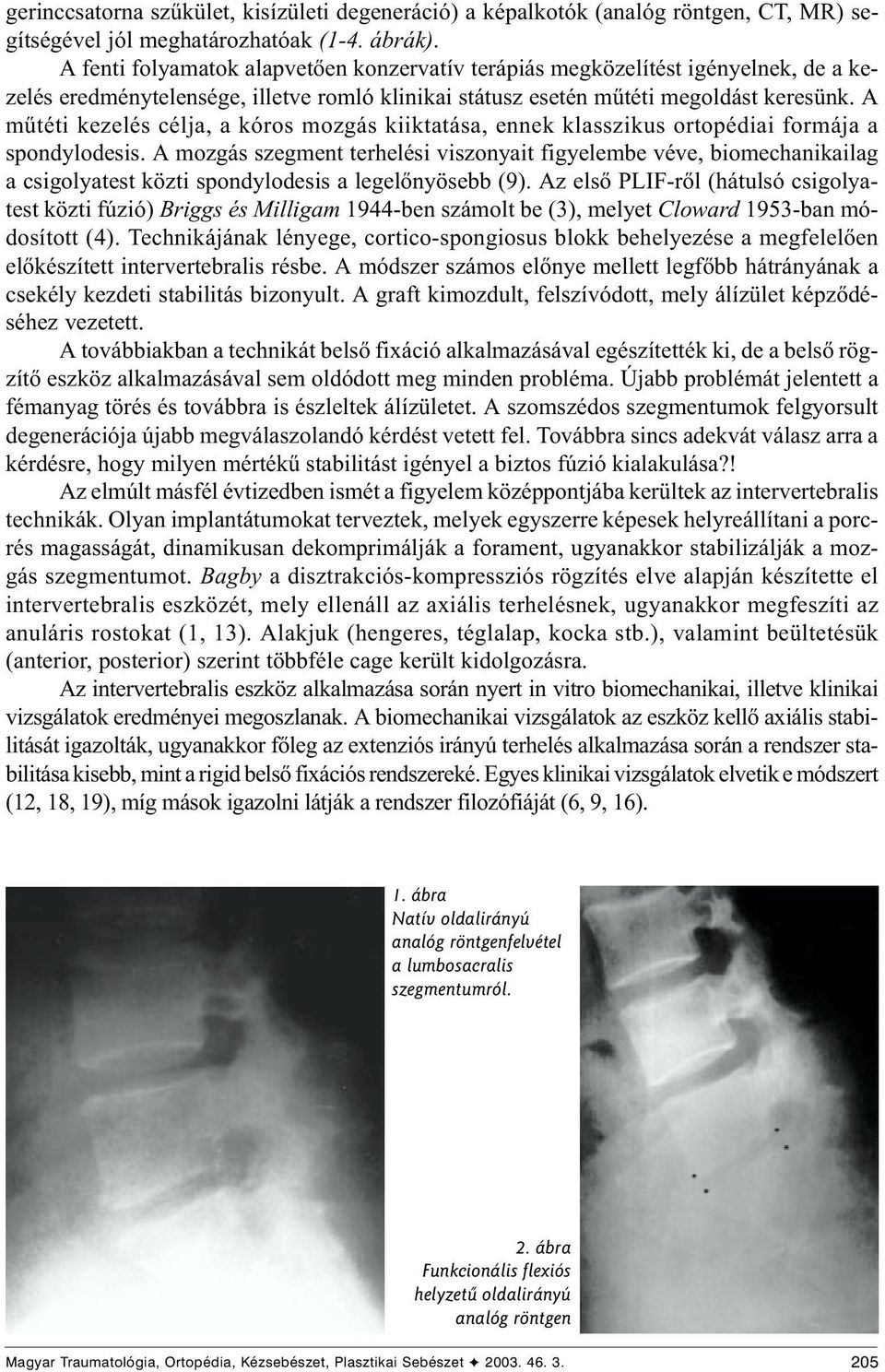 A mûtéti kezelés célja, a kóros mozgás kiiktatása, ennek klasszikus ortopédiai formája a spondylodesis.