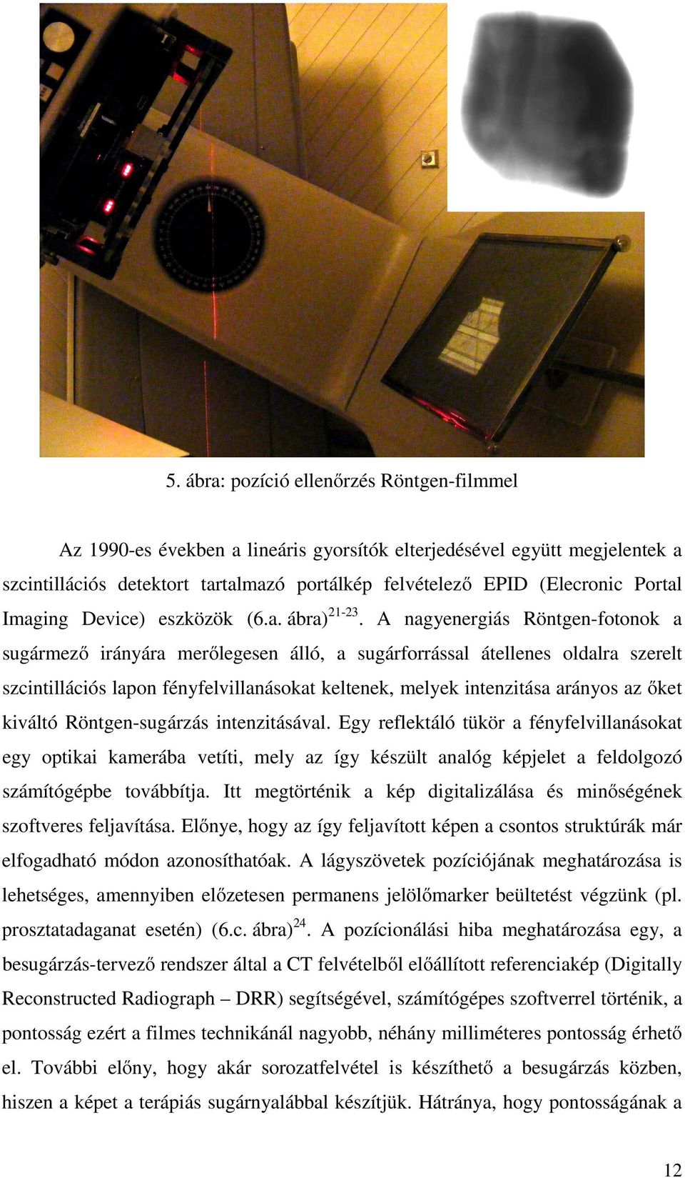 A nagyenergiás Röntgen-fotonok a sugármező irányára merőlegesen álló, a sugárforrással átellenes oldalra szerelt szcintillációs lapon fényfelvillanásokat keltenek, melyek intenzitása arányos az őket