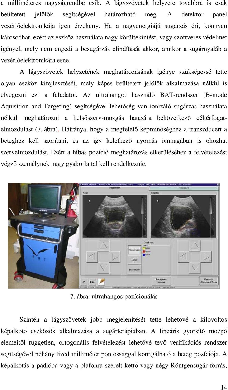 sugárnyaláb a vezérlőelektronikára esne.