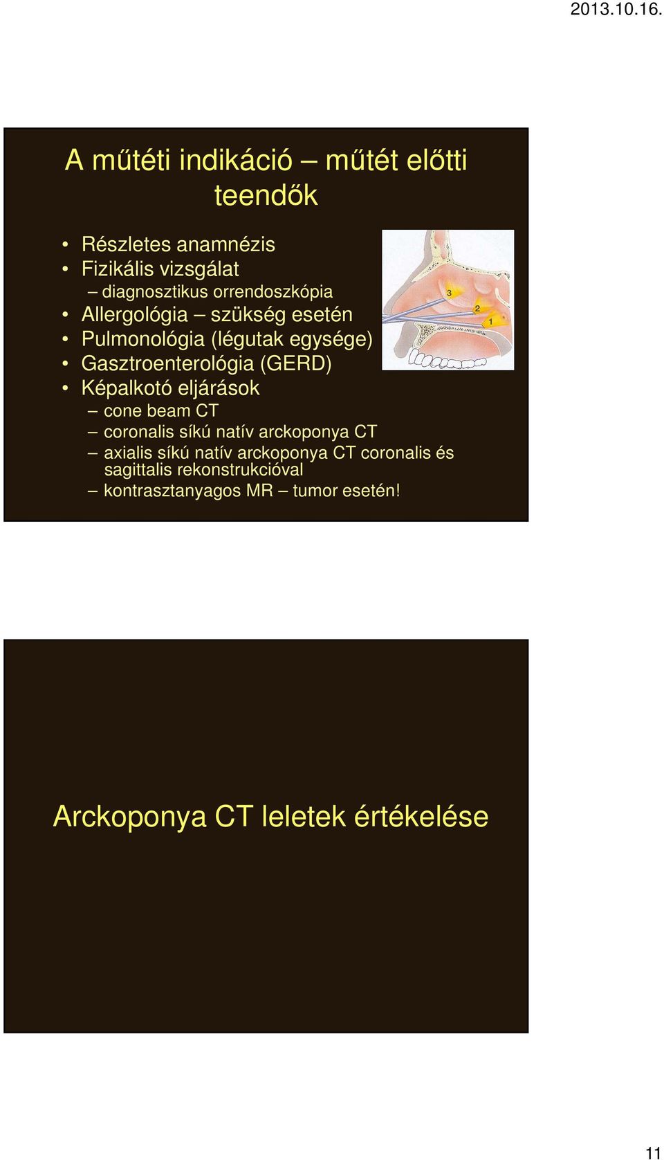 Képalkotó eljárások cone beam CT coronalis síkú natív arckoponya CT axialis síkú natív arckoponya CT