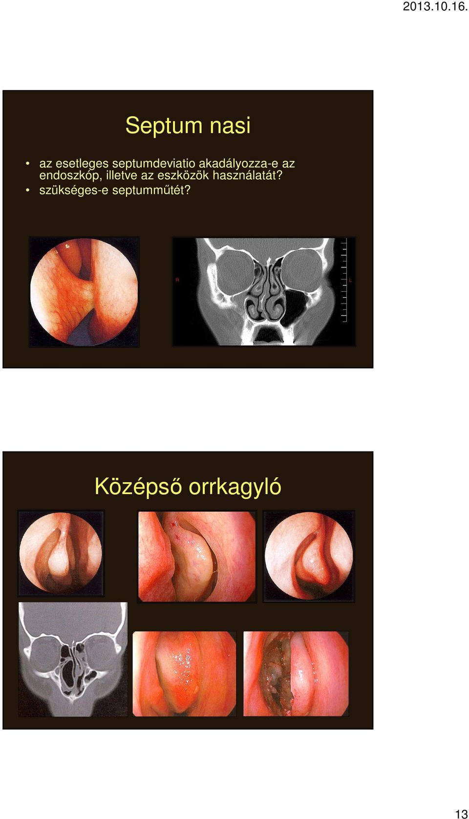 endoszkóp, illetve az eszközök