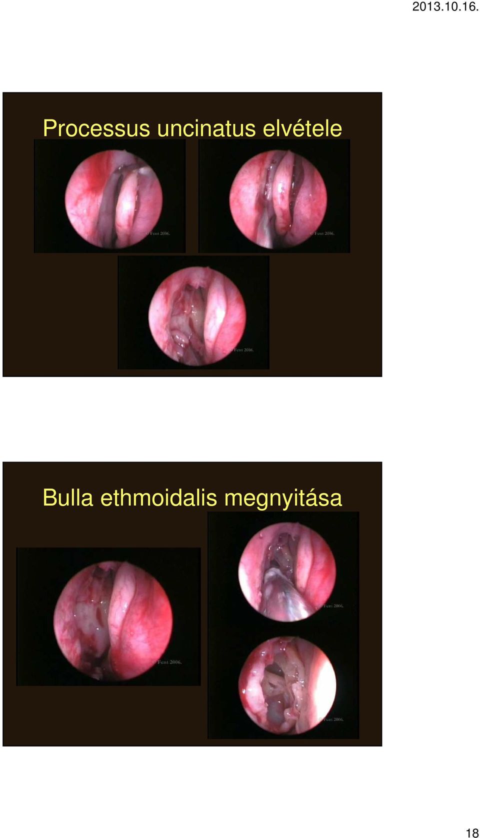 elvétele Bulla