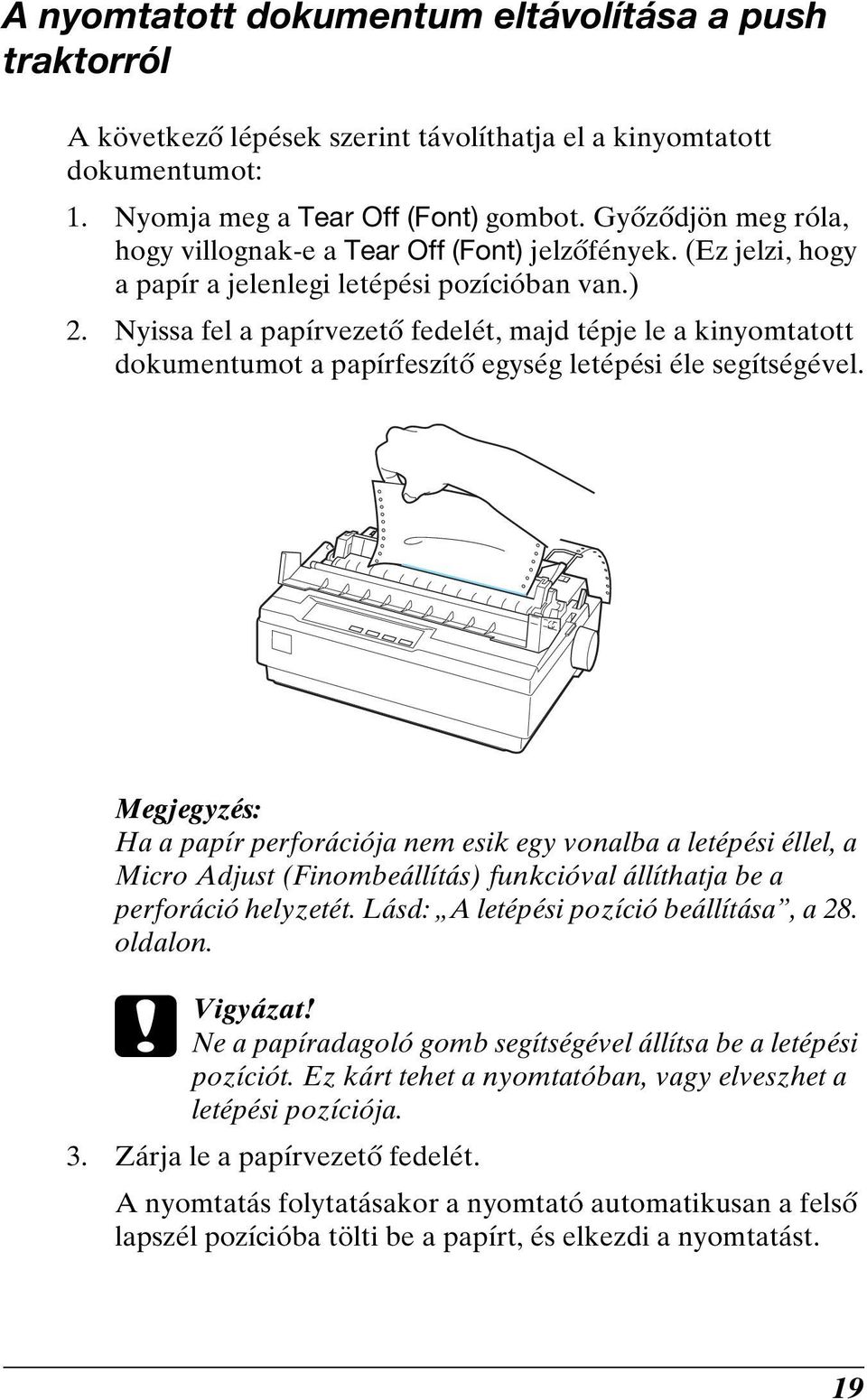 Nyissa fel a papírvezető fedelét, majd tépje le a kinyomtatott dokumentumot a papírfeszítő egység letépési éle segítségével.