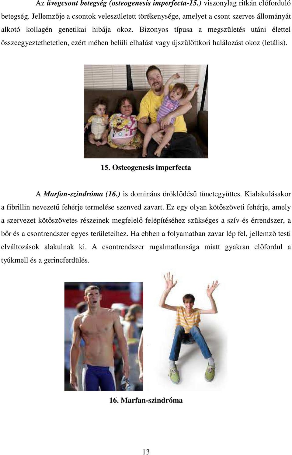 Bizonyos típusa a megszületés utáni élettel összeegyeztethetetlen, ezért méhen belüli elhalást vagy újszülöttkori halálozást okoz (letális). 15. Osteogenesis imperfecta A Marfan-szindróma (16.