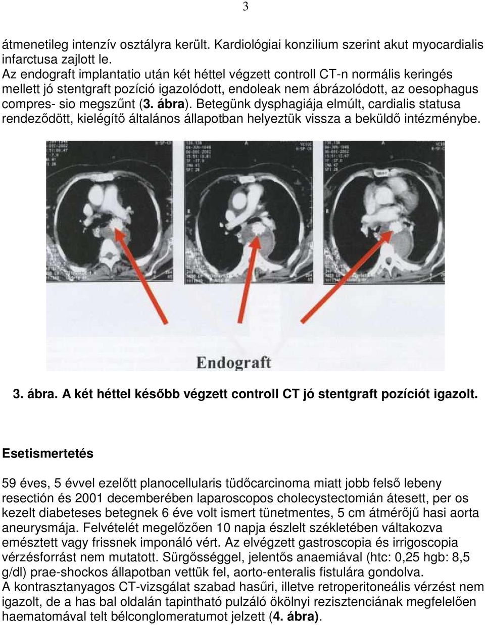 Betegünk dysphagiája elmúlt, cardialis statusa rendezıdött, kielégítı általános állapotban helyeztük vissza a beküldı intézménybe. 3. ábra.