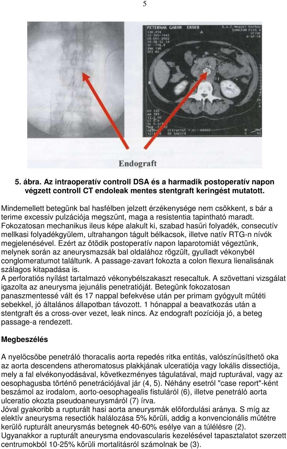 Fokozatosan mechanikus ileus képe alakult ki, szabad hasőri folyadék, consecutív mellkasi folyadékgyülem, ultrahangon tágult bélkacsok, illetve natív RTG-n nívók megjelenésével.