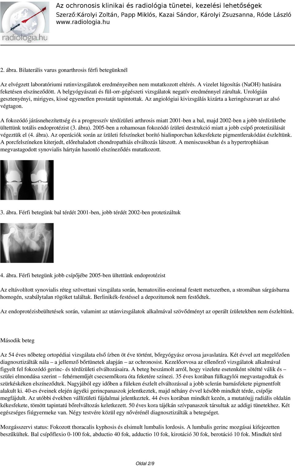 Urológián gesztenyényi, mirigyes, kissé egyenetlen prostatát tapintottak. Az angiológiai kivizsgálás kizárta a keringészavart az alsó végtagon.
