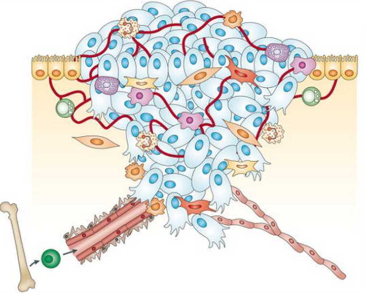 1. ábra: A primér tumor mikrokörnyezete. A primér tumorban található daganatos sejtek mellett számos egyéb sztróma sejt is megtalálható.