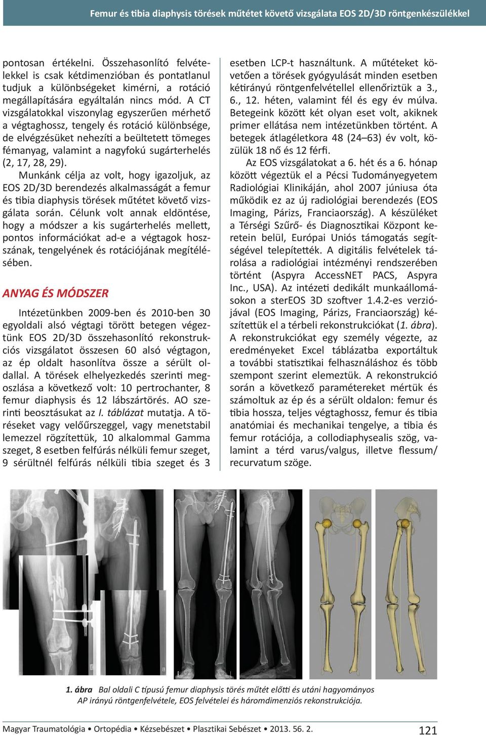A CT vizsgálatokkal viszonylag egyszerűen mérhető a végtaghossz, tengely és rotáció különbsége, de elvégzésüket nehezíti a beültetett tömeges fémanyag, valamint a nagyfokú sugárterhelés (2, 17, 28,