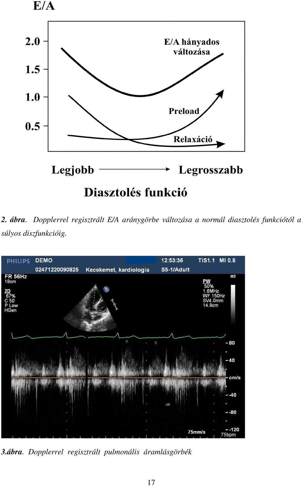 változása a normál diasztolés funkciótól a