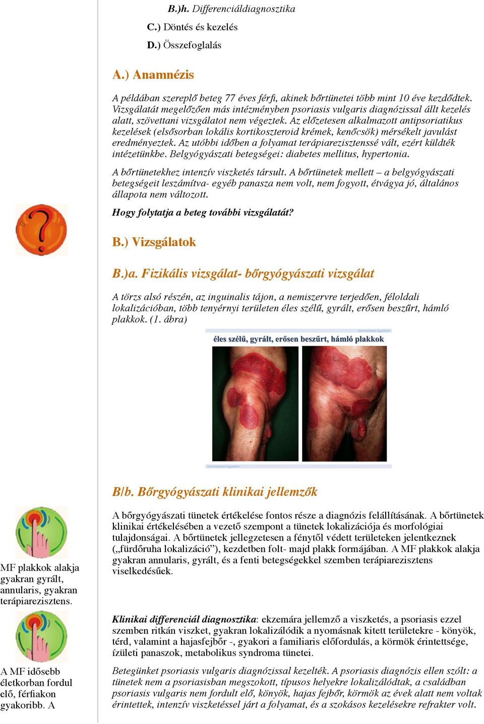 Az előzetesen alkalmazott antipsoriatikus kezelések (elsősorban lokális kortikoszteroid krémek, kenőcsök) mérsékelt javulást eredményeztek.