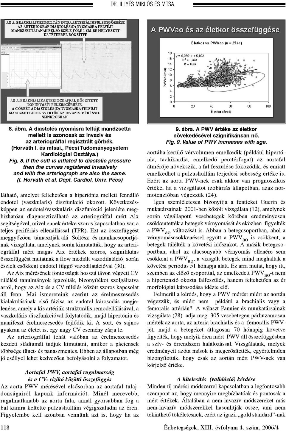 Horváth et al. Dept. Cardiol. Univ. Pécs) látható, amelyet feltehetõen a hipertónia mellett fennálló endotel (vaszkularis) diszfunkció okozott.