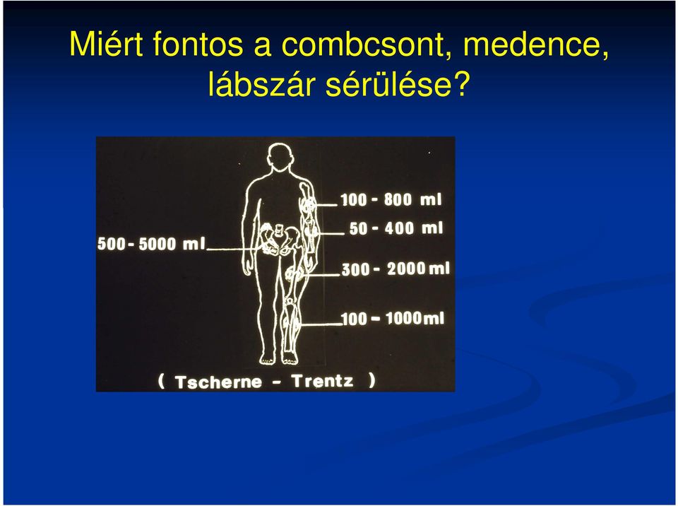 medence,