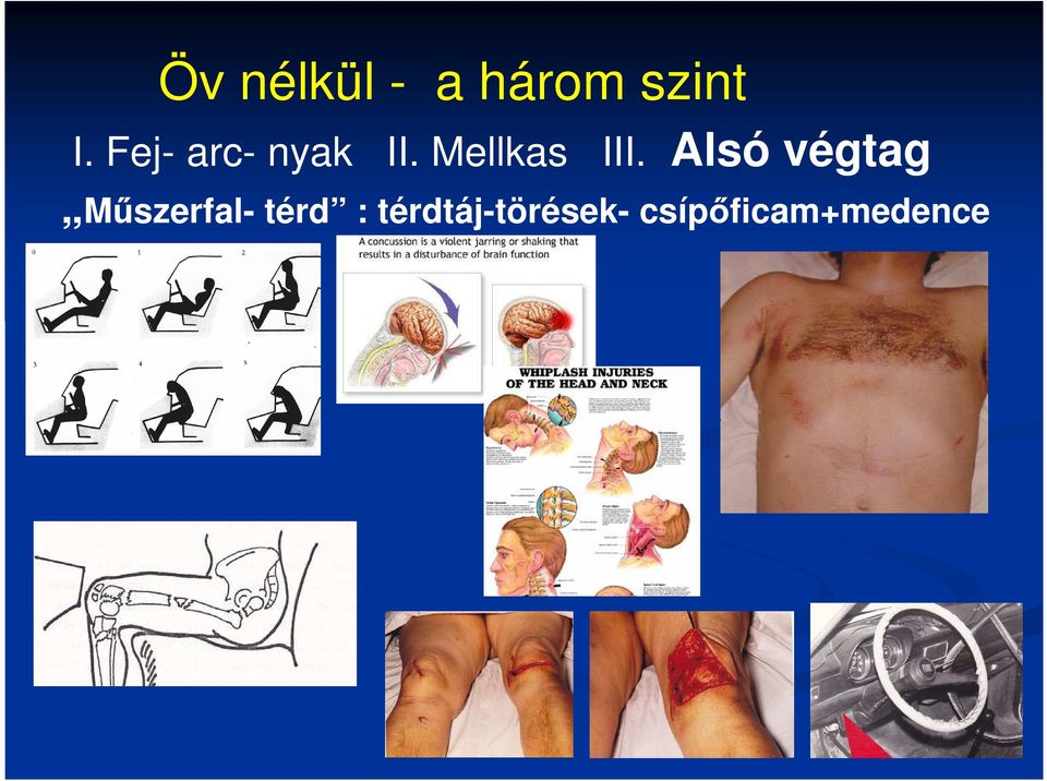 Alsó végtag Műszerfal- térd :