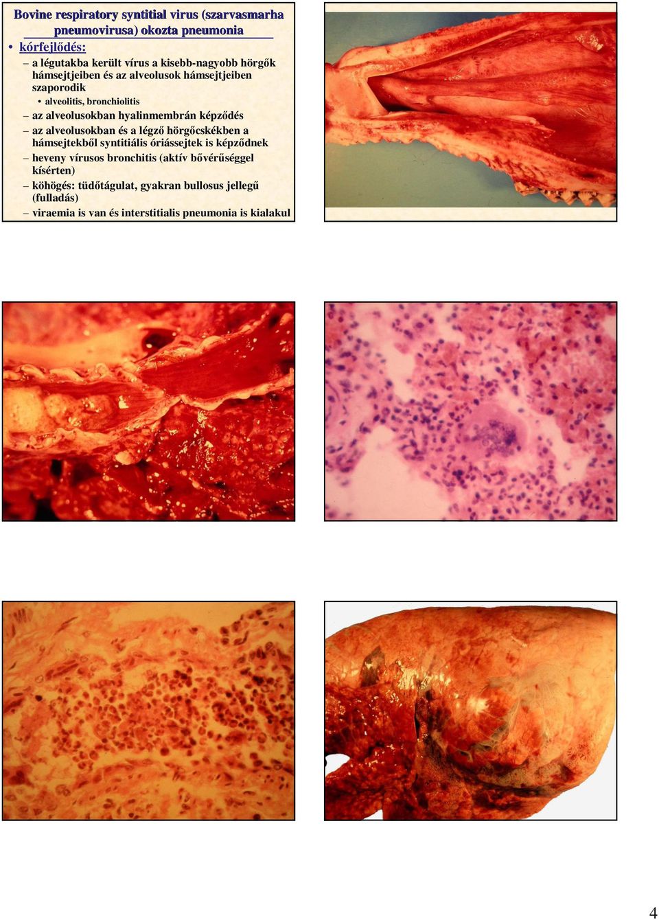 az alveolusokban és a légzı hörgıcskékben a hámsejtekbıl syntitiális óriássejtek is képzıdnek heveny vírusos bronchitis (aktív