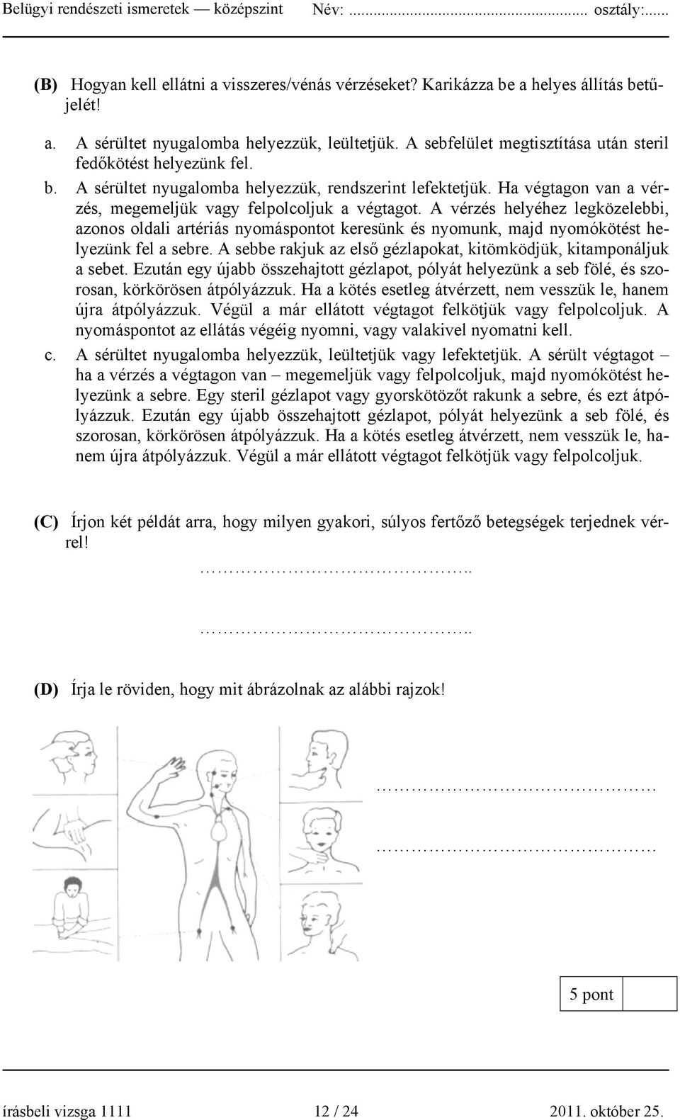A vérzés helyéhez legközelebbi, azonos oldali artériás nyomáspontot keresünk és nyomunk, majd nyomókötést helyezünk fel a sebre. A sebbe rakjuk az első gézlapokat, kitömködjük, kitamponáljuk a sebet.