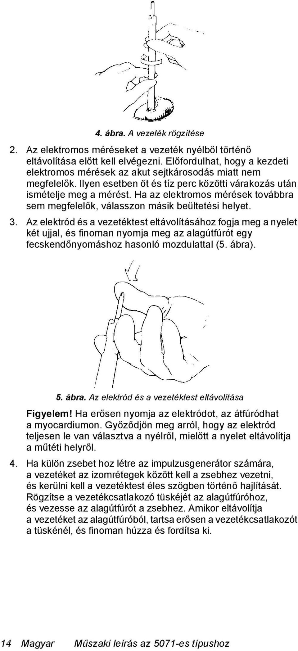 Ha az elektromos mérések továbbra sem megfelelők, válasszon másik beültetési helyet. 3.