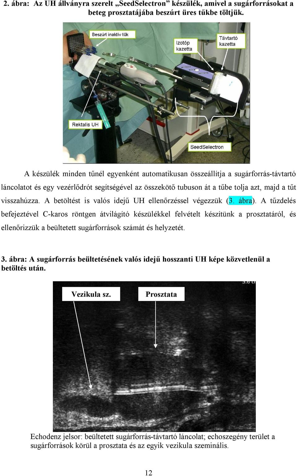 A betöltést is valós idejű UH ellenőrzéssel végezzük (3. ábra).