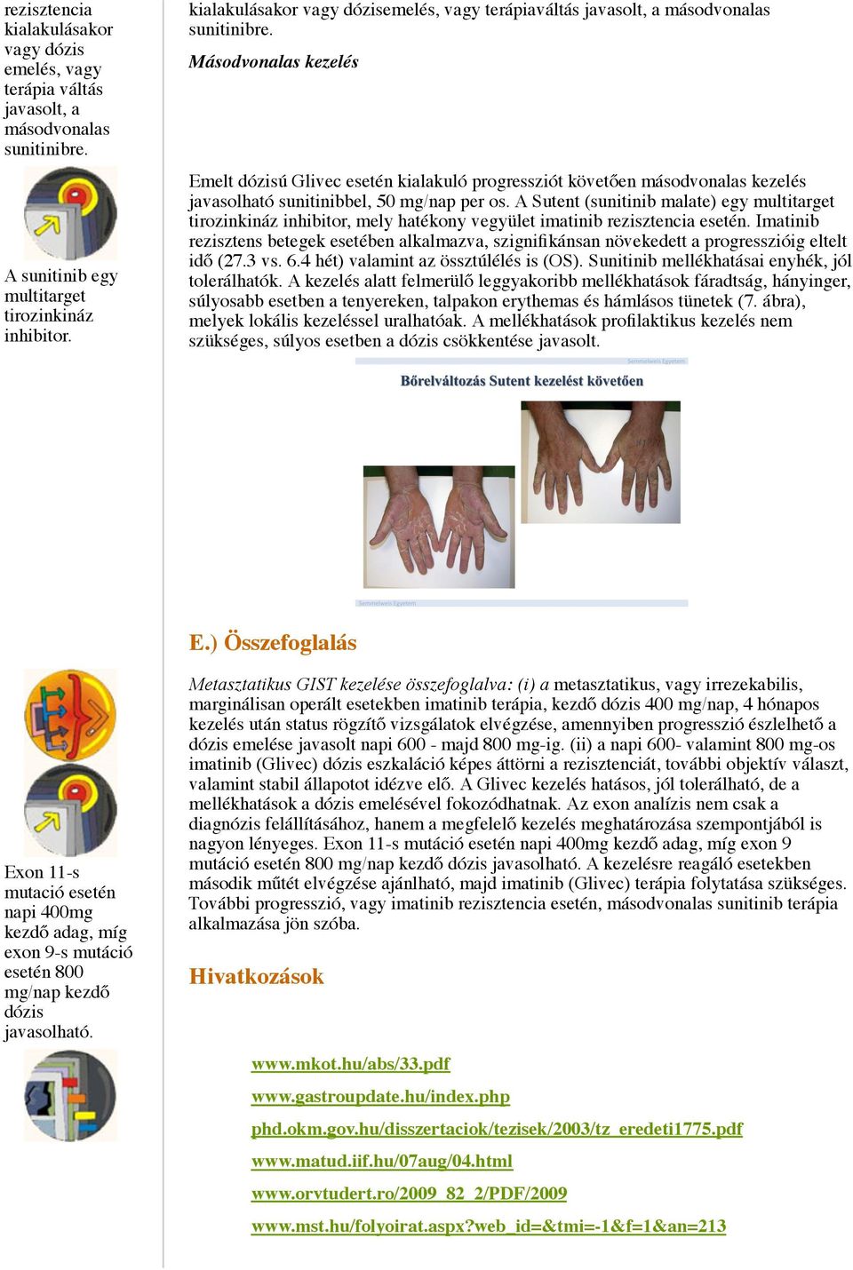 Másodvonalas kezelés Emelt dózisú Glivec esetén kialakuló progressziót követően másodvonalas kezelés javasolható sunitinibbel, 50 mg/nap per os.