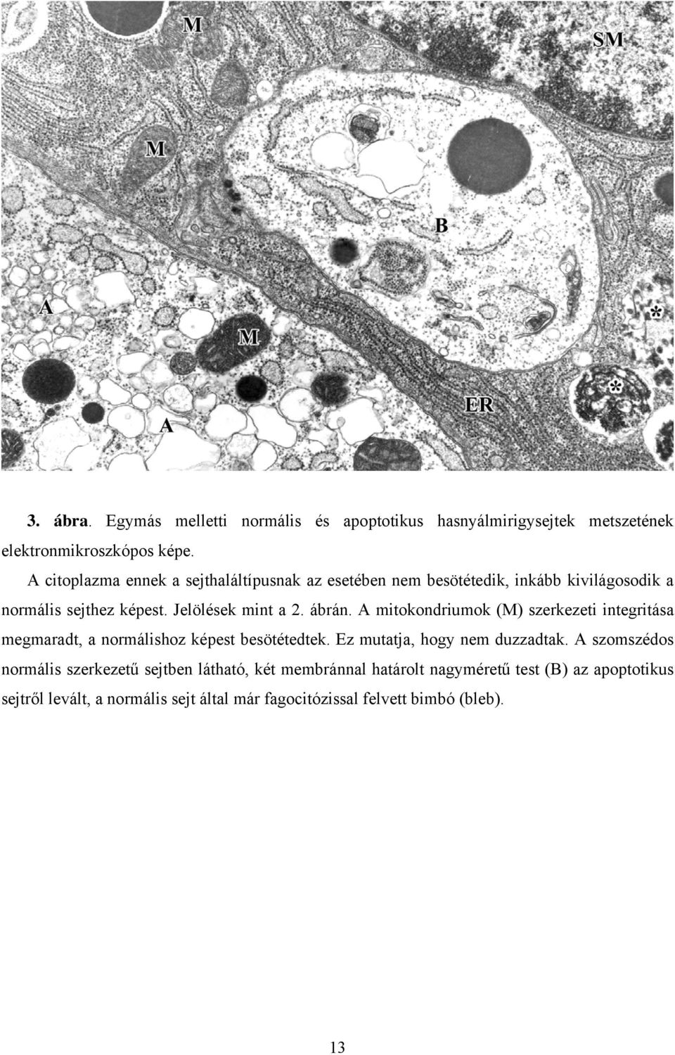 ábrán. A mitokondriumok (M) szerkezeti integritása megmaradt, a normálishoz képest besötétedtek. Ez mutatja, hogy nem duzzadtak.
