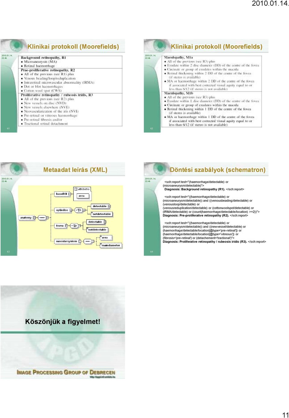 </sch:report> <sch:report test="((haemorrhage/detectable) or (microaneurysm/detectable)) and ((venousbeading/detectable) or (venousloop/detectable) or (venousreduplication/detectable) or