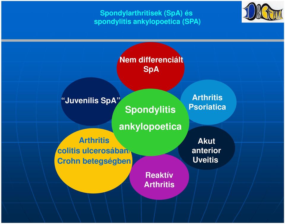 colitis ulcerosában/ Crohn betegségben Spondylitis