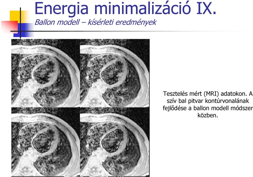 Tesztelés mért (MRI) adatokon.