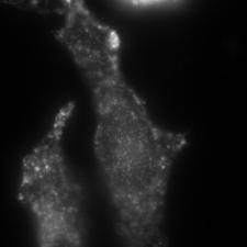 a. 561 nm-tirf c. 561nm -dstorm e. Egyesített e4 e1 20 μm b. 640 nm-tirf d. 5 μm 640nm-dSTORM e3 20 μm e1 e2 e3 e2 5 μm 5 μm e4 FWHM=260 nm f1 f2 f3 f4 FWHM=185 nm 200 nm 49.
