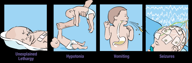 Ureaciklus zavarai Carbamoyl foszfát szintetáz I (CPSI) deficiencia, Ornitin transzkarbamiláz (OTC) deficiencia, Argininoszukcinát szintetáz (ASS) deficiencia, Argininoszukcinát liáz (ASL)