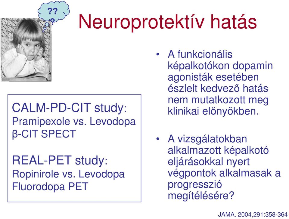 Levodopa Fluorodopa PET A funkcionális képalkotókon dopamin agonisták esetében észlelt kedvező