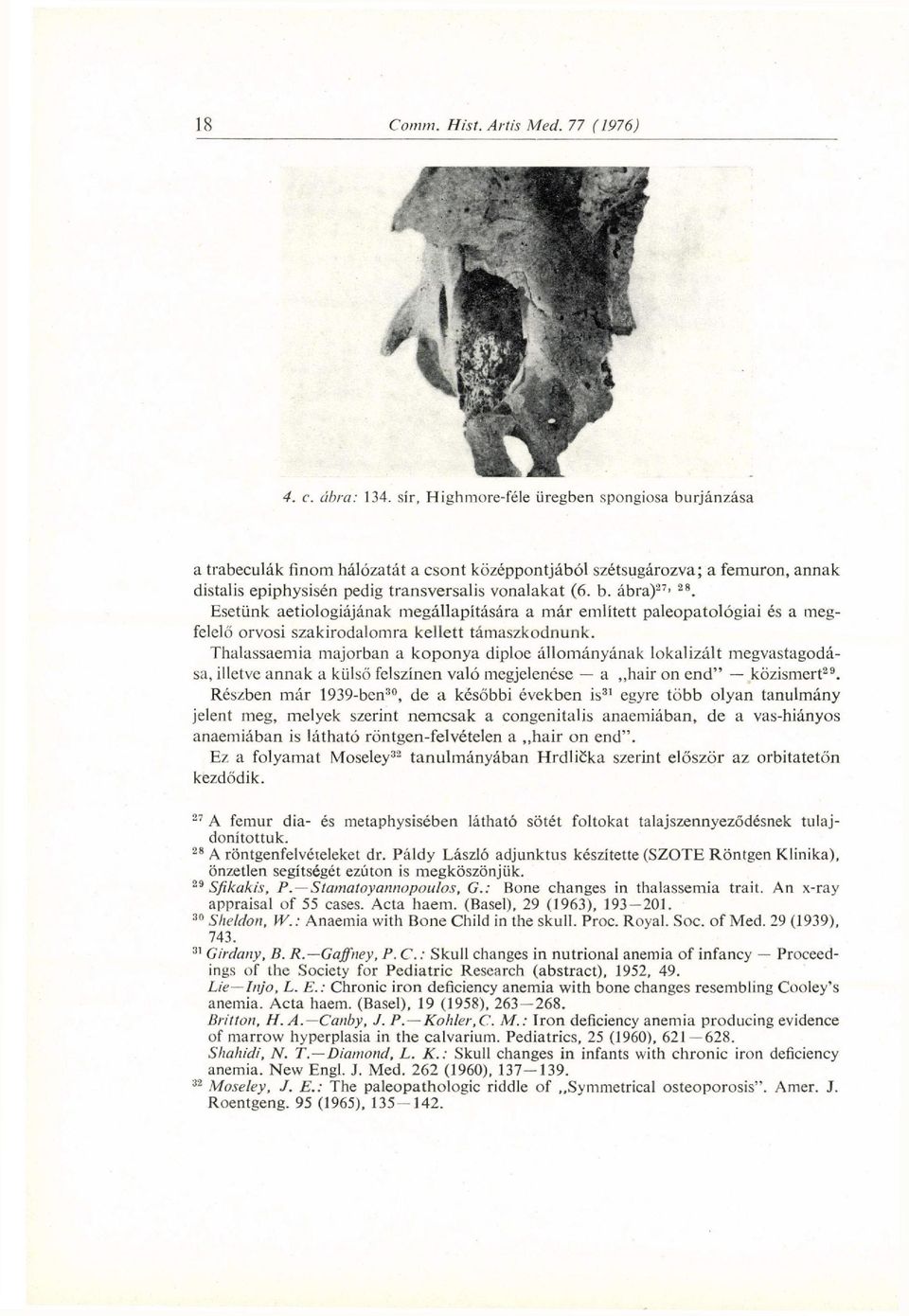 Esetünk aetiologiájának megállapítására a már említett paleopatológiai és a megfelelő orvosi szakirodalomra kellett támaszkodnunk.