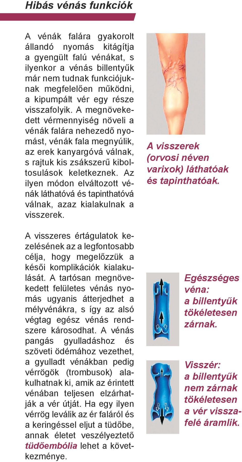 Az ilyen módon elváltozott vénák láthatóvá és tapinthatóvá válnak, azaz kialakulnak a visszerek.