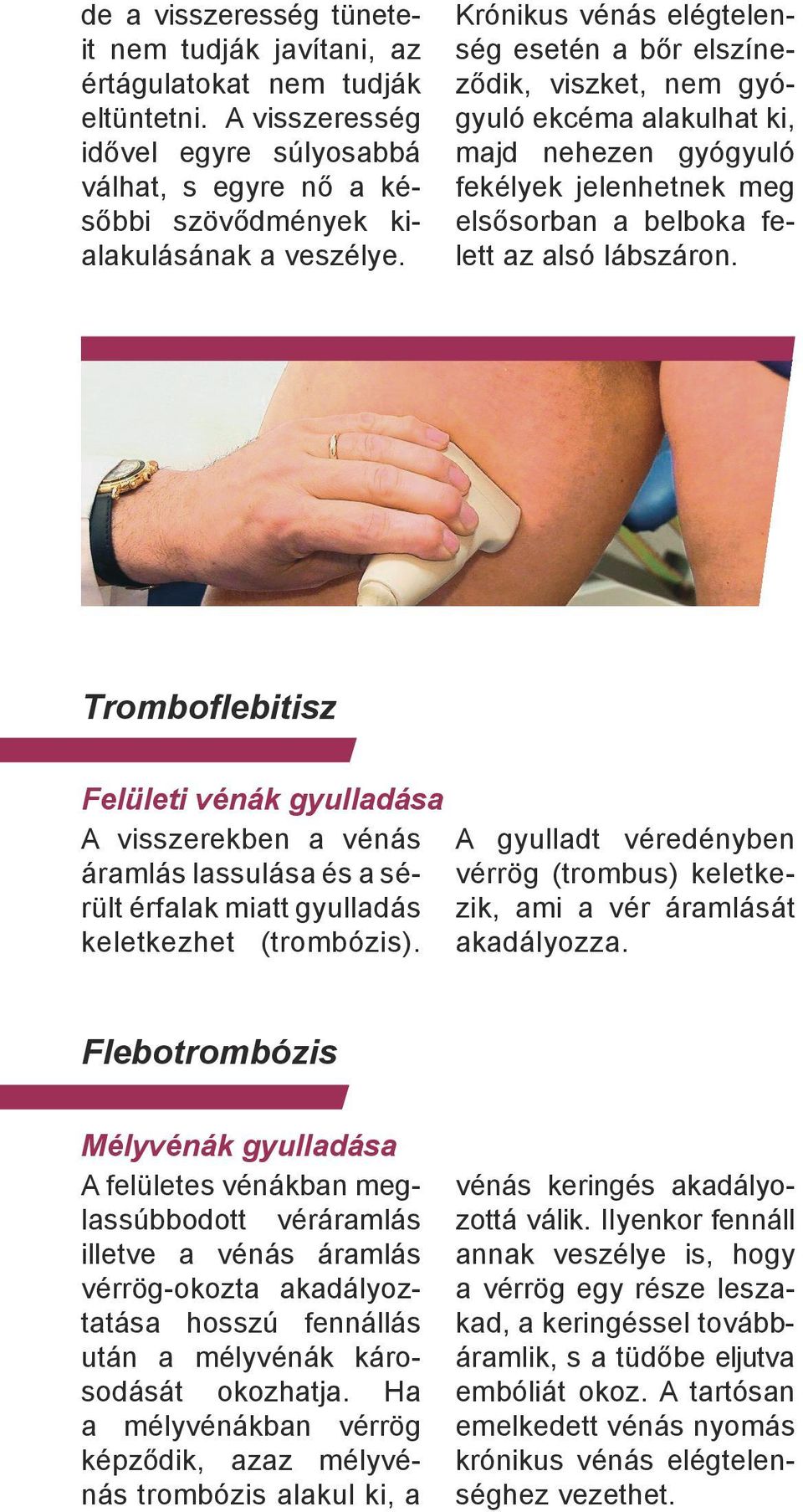 Tromboflebitisz Felületi vénák gyulladása A visszerekben a vénás áramlás lassulása és a sérült érfalak miatt gyulladás keletkezhet (trombózis).