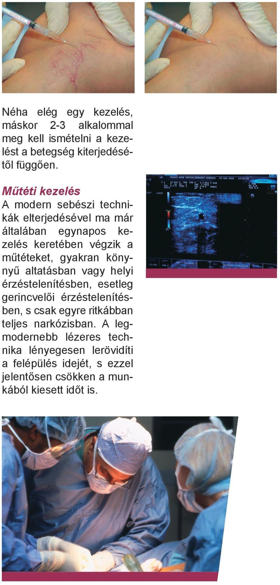 gyakran könynyű altatásban vagy helyi érzéstelenítésben, esetleg gerincvelői érzéstelenítésben, s csak egyre ritkábban