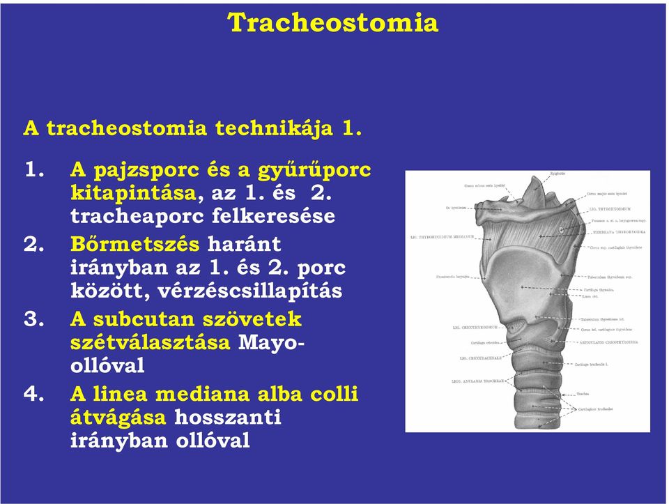 tracheaporc felkeresése 2. Bőrmetszés haránt irányban az 1. és 2.