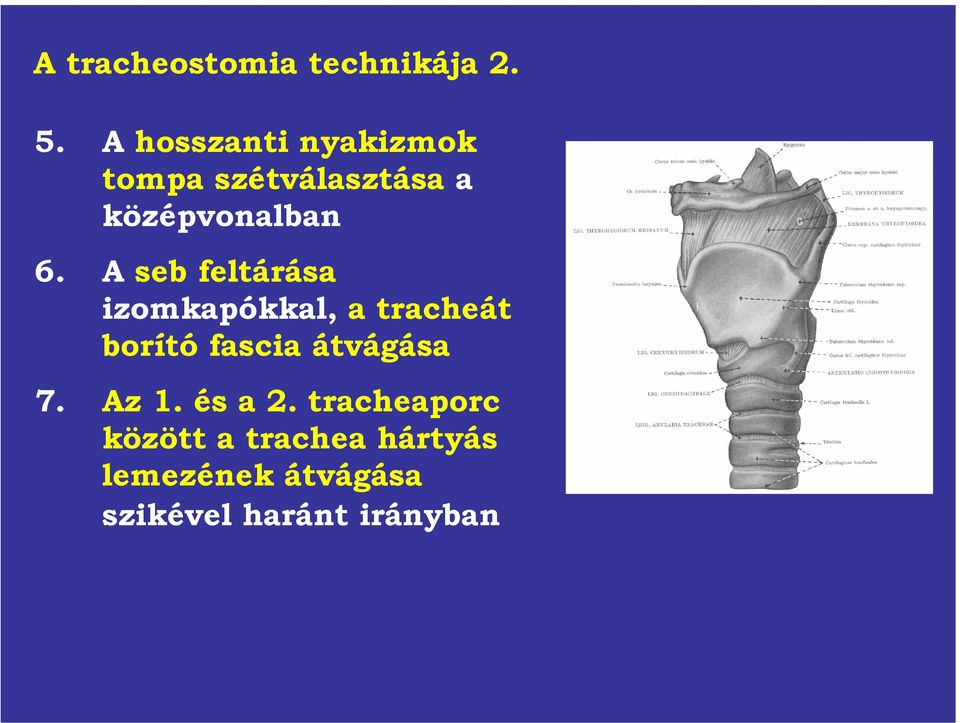 A seb feltárása izomkapókkal, a tracheát borító fascia átvágása