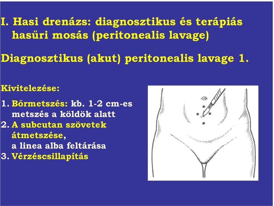 Kivitelezése: 1. Bőrmetszés: kb.