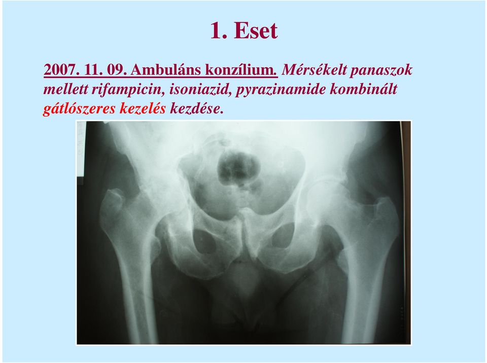 Mérsékelt panaszok mellett