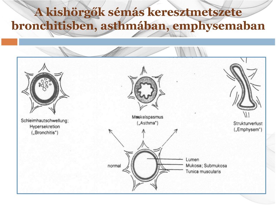 bronchitisben,