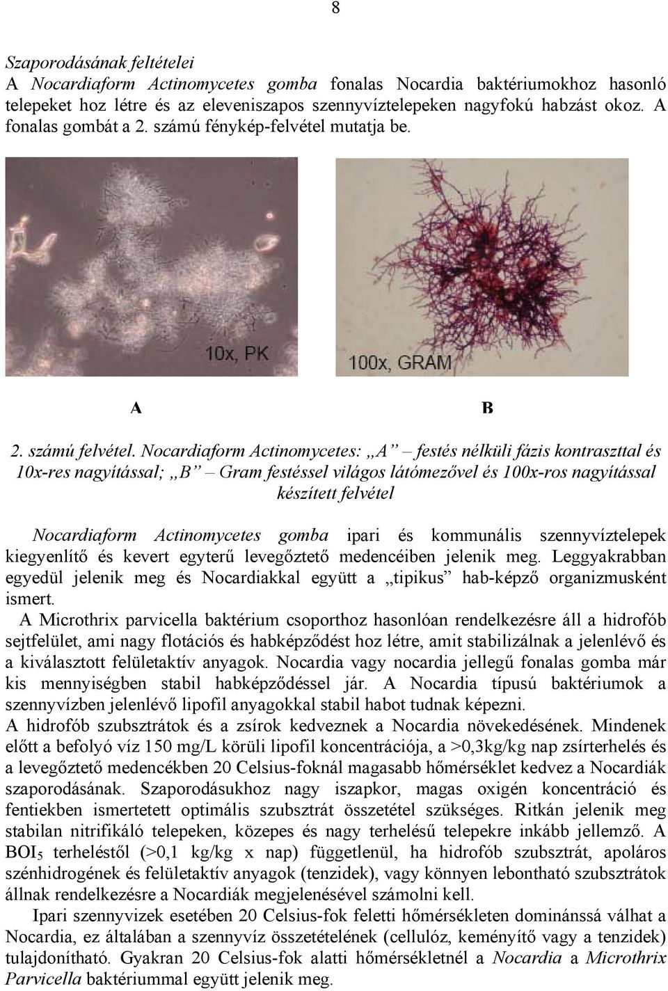 Nocardiaform Actinomycetes: A festés nélküli fázis kontraszttal és 10x-res nagyítással; B Gram festéssel világos látómezővel és 100x-ros nagyítással készített felvétel Nocardiaform Actinomycetes