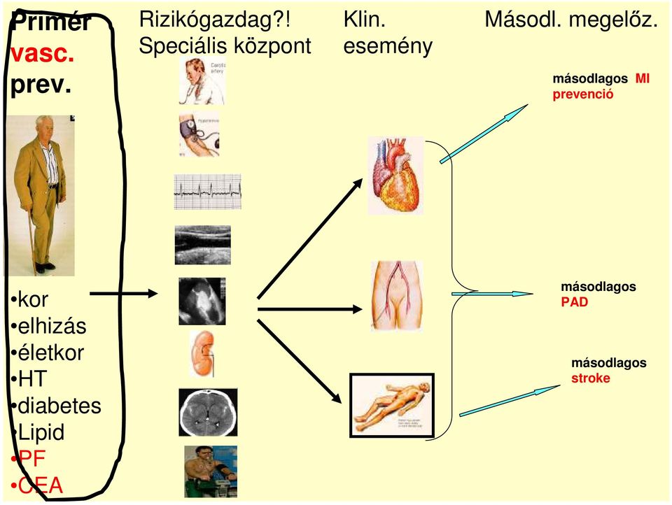 esemény másodlagos MI prevenció kor elhizás