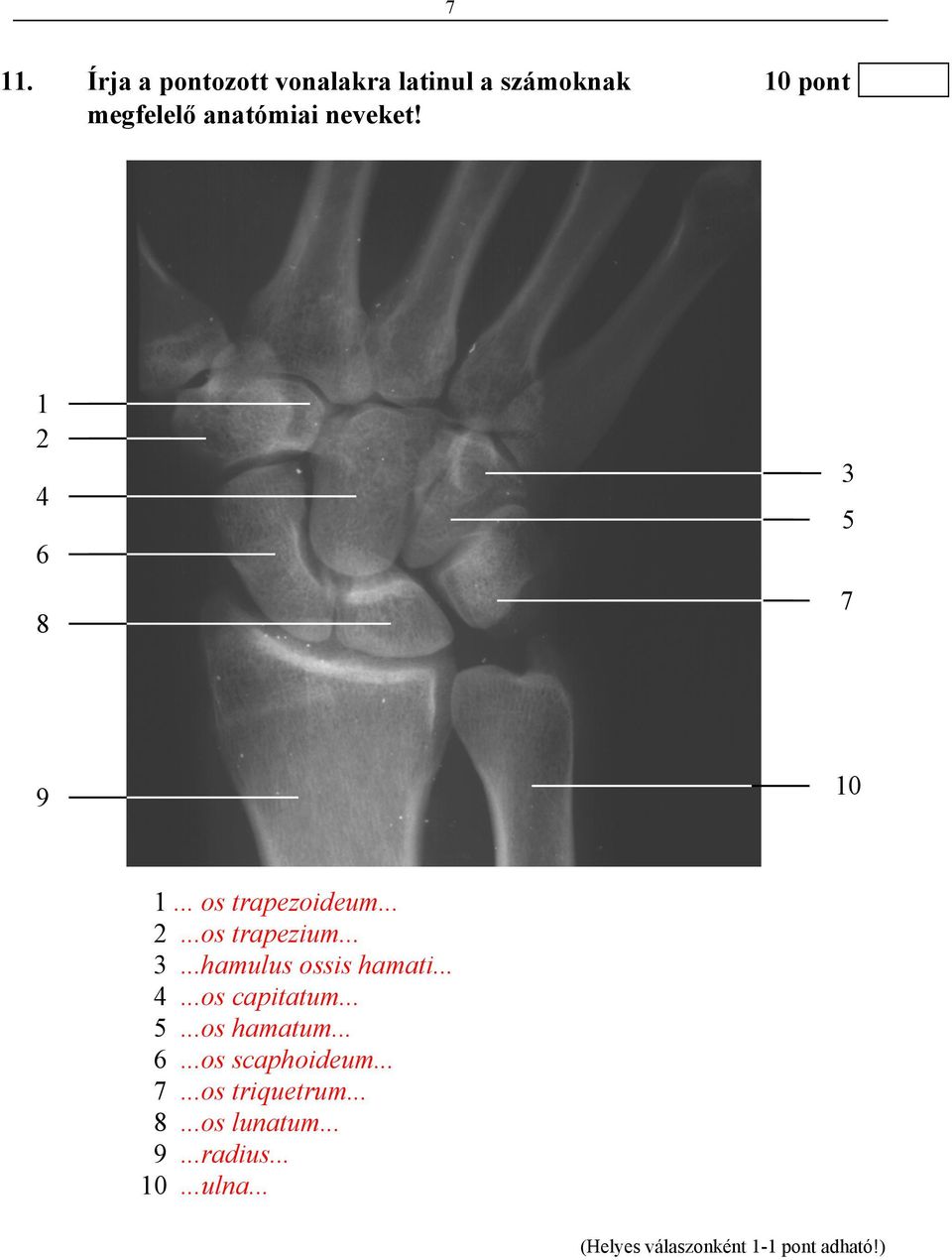 .. 3...hamulus ossis hamati... 4...os capitatum... 5...os hamatum... 6.