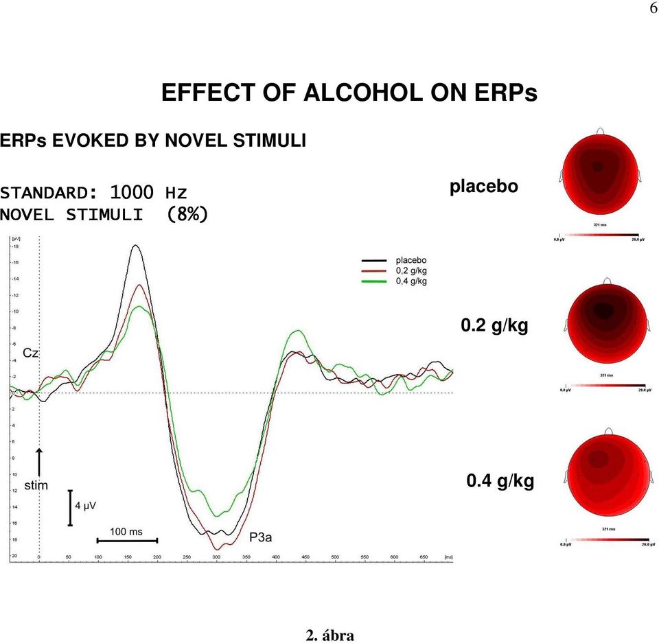 STANDARD: 1000 Hz NOVEL STIMULI