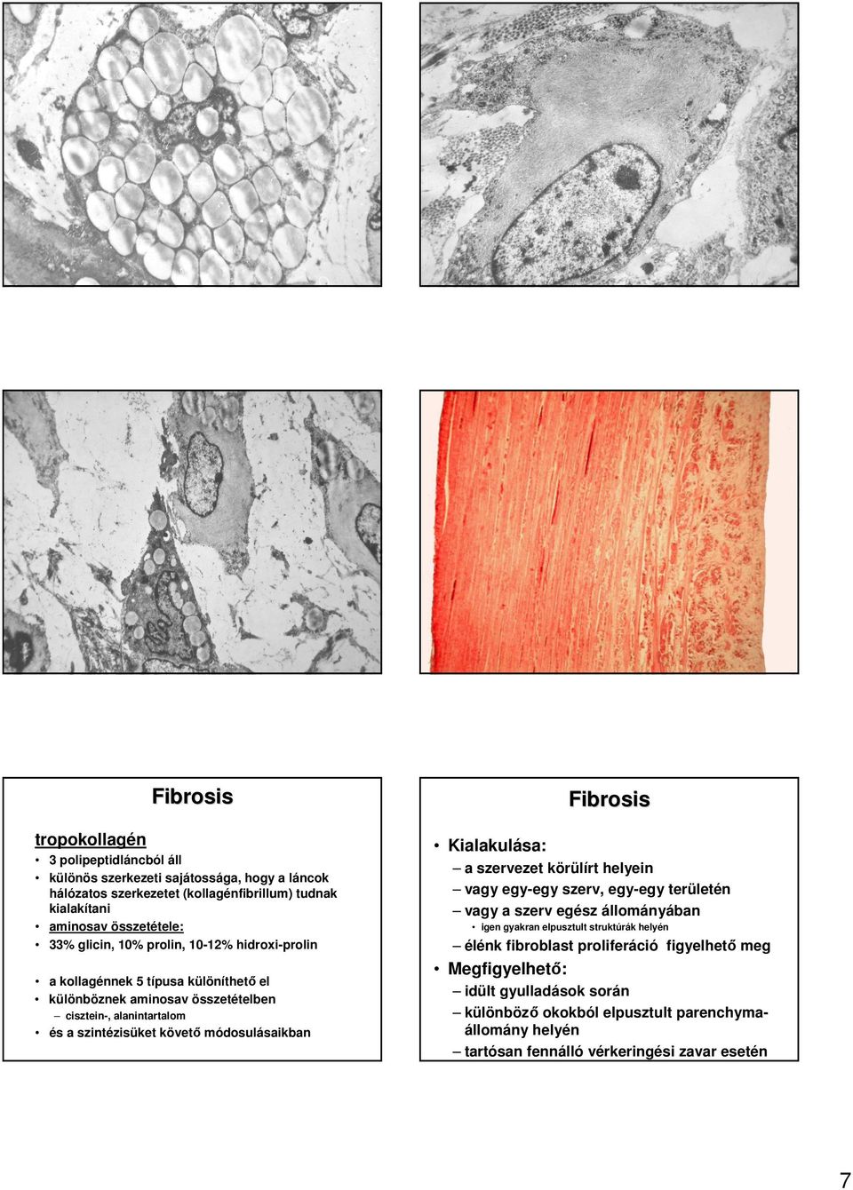 módosulásaikban Fibrosis Kialakulása: a szervezet körülírt helyein vagy egy-egy szerv, egy-egy területén vagy a szerv egész állományában igen gyakran elpusztult struktúrák