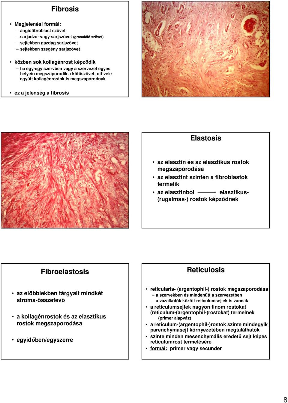 megszaporodása az elasztint szintén a fibroblastok termelik az elasztinból elasztikus- (rugalmas-) rostok képzıdnek Fibroelastosis Reticulosis az elıbbiekben tárgyalt mindkét stroma-összetevı a