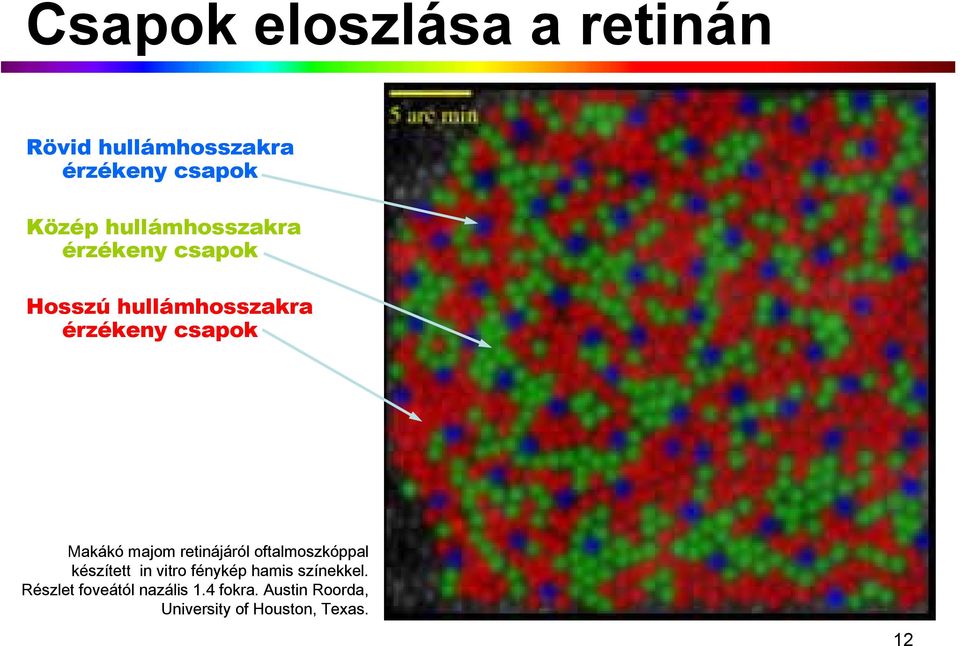 majom retinájáról oftalmoszkóppal készített in vitro fénykép hamis színekkel.